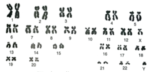 Full set of chromosomes in a normal human male
