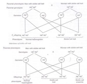 sickle cell anaemia inheritance